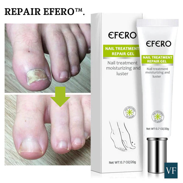 Gel de uñas anti hongos y bacterias 🦠 - Repair Efero®