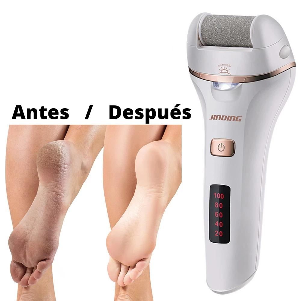 Removedor de Callos 🦶 Recargable USB 🔋