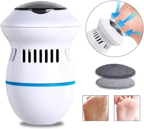 Removedor de Callos 🦶 Electrico Recargable 🔋